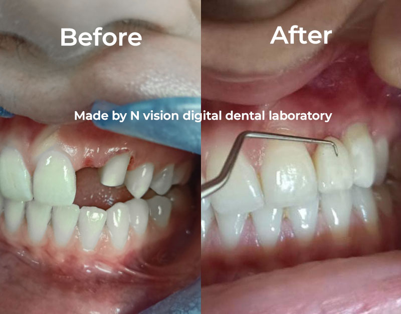 N Vision Digital Dental Laboratory